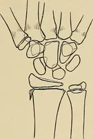 An illustration from Surgical diagnosis / by Edward Martin ... illustrated with 445 engravings and 18 plates in colors and monochrome. (1909)