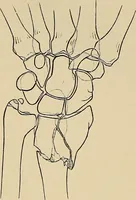 An illustration from Surgical diagnosis / by Edward Martin ... illustrated with 445 engravings and 18 plates in colors and monochrome. (1909)