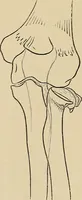 An illustration from Surgical diagnosis / by Edward Martin ... illustrated with 445 engravings and 18 plates in colors and monochrome. (1909)