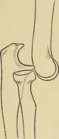 An illustration from Surgical diagnosis / by Edward Martin ... illustrated with 445 engravings and 18 plates in colors and monochrome. (1909)