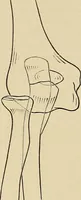 An illustration from Surgical diagnosis / by Edward Martin ... illustrated with 445 engravings and 18 plates in colors and monochrome. (1909)