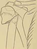 An illustration from Surgical diagnosis / by Edward Martin ... illustrated with 445 engravings and 18 plates in colors and monochrome. (1909)