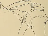 An illustration from Surgical diagnosis / by Edward Martin ... illustrated with 445 engravings and 18 plates in colors and monochrome. (1909)