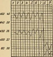 An illustration from Atlas of methods of clinical investigation : with an epitome of clinical diagnosis and of special pathology and treatment of internal diseases / By Dr. Christfried Jakob ... Authorized translation from the German. Ed. by Augustus A. Eshner ... With 182 colored illustrations upon 68 plates, and 64 illustrations in the text. (1898)