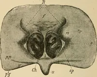 An illustration from Atlas of methods of clinical investigation : with an epitome of clinical diagnosis and of special pathology and treatment of internal diseases / By Dr. Christfried Jakob ... Authorized translation from the German. Ed. by Augustus A. Eshner ... With 182 colored illustrations upon 68 plates, and 64 illustrations in the text. (1898)