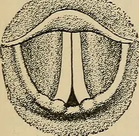 An illustration from Atlas of methods of clinical investigation : with an epitome of clinical diagnosis and of special pathology and treatment of internal diseases / By Dr. Christfried Jakob ... Authorized translation from the German. Ed. by Augustus A. Eshner ... With 182 colored illustrations upon 68 plates, and 64 illustrations in the text. (1898)