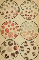 An illustration from Atlas of methods of clinical investigation : with an epitome of clinical diagnosis and of special pathology and treatment of internal diseases / By Dr. Christfried Jakob ... Authorized translation from the German. Ed. by Augustus A. Eshner ... With 182 colored illustrations upon 68 plates, and 64 illustrations in the text. (1898)