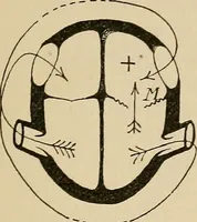 An illustration from Atlas of methods of clinical investigation : with an epitome of clinical diagnosis and of special pathology and treatment of internal diseases / By Dr. Christfried Jakob ... Authorized translation from the German. Ed. by Augustus A. Eshner ... With 182 colored illustrations upon 68 plates, and 64 illustrations in the text. (1898)
