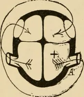 An illustration from Atlas of methods of clinical investigation : with an epitome of clinical diagnosis and of special pathology and treatment of internal diseases / By Dr. Christfried Jakob ... Authorized translation from the German. Ed. by Augustus A. Eshner ... With 182 colored illustrations upon 68 plates, and 64 illustrations in the text. (1898)