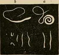 An illustration from Atlas of methods of clinical investigation : with an epitome of clinical diagnosis and of special pathology and treatment of internal diseases / By Dr. Christfried Jakob ... Authorized translation from the German. Ed. by Augustus A. Eshner ... With 182 colored illustrations upon 68 plates, and 64 illustrations in the text. (1898)