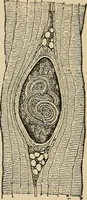 An illustration from Atlas of methods of clinical investigation : with an epitome of clinical diagnosis and of special pathology and treatment of internal diseases / By Dr. Christfried Jakob ... Authorized translation from the German. Ed. by Augustus A. Eshner ... With 182 colored illustrations upon 68 plates, and 64 illustrations in the text. (1898)