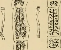 An illustration from Atlas of methods of clinical investigation : with an epitome of clinical diagnosis and of special pathology and treatment of internal diseases / By Dr. Christfried Jakob ... Authorized translation from the German. Ed. by Augustus A. Eshner ... With 182 colored illustrations upon 68 plates, and 64 illustrations in the text. (1898)