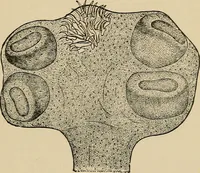 An illustration from Atlas of methods of clinical investigation : with an epitome of clinical diagnosis and of special pathology and treatment of internal diseases / By Dr. Christfried Jakob ... Authorized translation from the German. Ed. by Augustus A. Eshner ... With 182 colored illustrations upon 68 plates, and 64 illustrations in the text. (1898)