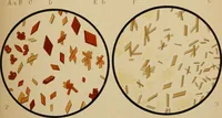 An illustration from Atlas of methods of clinical investigation : with an epitome of clinical diagnosis and of special pathology and treatment of internal diseases / By Dr. Christfried Jakob ... Authorized translation from the German. Ed. by Augustus A. Eshner ... With 182 colored illustrations upon 68 plates, and 64 illustrations in the text. (1898)