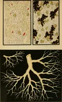An illustration from Atlas of methods of clinical investigation : with an epitome of clinical diagnosis and of special pathology and treatment of internal diseases / By Dr. Christfried Jakob ... Authorized translation from the German. Ed. by Augustus A. Eshner ... With 182 colored illustrations upon 68 plates, and 64 illustrations in the text. (1898)