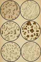An illustration from Atlas of methods of clinical investigation : with an epitome of clinical diagnosis and of special pathology and treatment of internal diseases / By Dr. Christfried Jakob ... Authorized translation from the German. Ed. by Augustus A. Eshner ... With 182 colored illustrations upon 68 plates, and 64 illustrations in the text. (1898)