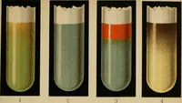 An illustration from Atlas of methods of clinical investigation : with an epitome of clinical diagnosis and of special pathology and treatment of internal diseases / By Dr. Christfried Jakob ... Authorized translation from the German. Ed. by Augustus A. Eshner ... With 182 colored illustrations upon 68 plates, and 64 illustrations in the text. (1898)