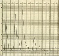 An illustration from The diseases of infancy and childhood : for the use of students and practitioners of medicine / by L. Emmett Holt and John Howland. (1911)