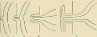 An illustration from The diseases of infancy and childhood : for the use of students and practitioners of medicine / by L. Emmett Holt and John Howland. (1911)