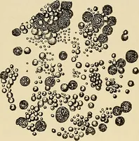 An illustration from The diseases of infancy and childhood : for the use of students and practitioners of medicine / by L. Emmett Holt and John Howland. (1911)