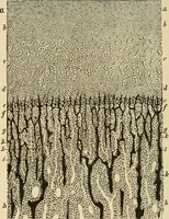 An illustration from The diseases of infancy and childhood : for the use of students and practitioners of medicine / by L. Emmett Holt and John Howland. (1911)
