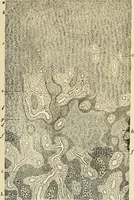 An illustration from The diseases of infancy and childhood : for the use of students and practitioners of medicine / by L. Emmett Holt and John Howland. (1911)