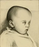 An illustration from The diseases of infancy and childhood : for the use of students and practitioners of medicine / by L. Emmett Holt and John Howland. (1911)