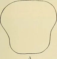 An illustration from The diseases of infancy and childhood : for the use of students and practitioners of medicine / by L. Emmett Holt and John Howland. (1911)