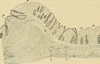 An illustration from The diseases of infancy and childhood : for the use of students and practitioners of medicine / by L. Emmett Holt and John Howland. (1911)