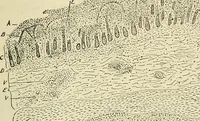 An illustration from The diseases of infancy and childhood : for the use of students and practitioners of medicine / by L. Emmett Holt and John Howland. (1911)