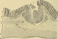 An illustration from The diseases of infancy and childhood : for the use of students and practitioners of medicine / by L. Emmett Holt and John Howland. (1911)
