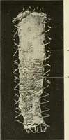 An illustration from The diseases of infancy and childhood : for the use of students and practitioners of medicine / by L. Emmett Holt and John Howland. (1911)