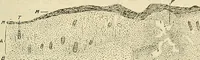An illustration from The diseases of infancy and childhood : for the use of students and practitioners of medicine / by L. Emmett Holt and John Howland. (1911)