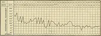 Picture 48 of 129 from The diseases of infancy and childhood : for the use of students and practitioners of medicine / by L. Emmett Holt and John Howland. (1911), leaf 421