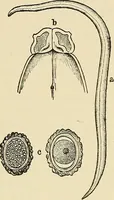An illustration from The diseases of infancy and childhood : for the use of students and practitioners of medicine / by L. Emmett Holt and John Howland. (1911)