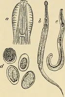 An illustration from The diseases of infancy and childhood : for the use of students and practitioners of medicine / by L. Emmett Holt and John Howland. (1911)