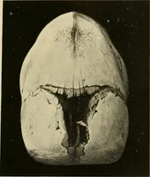 An illustration from The diseases of infancy and childhood : for the use of students and practitioners of medicine / by L. Emmett Holt and John Howland. (1911)