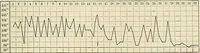 Picture 58 of 129 from The diseases of infancy and childhood : for the use of students and practitioners of medicine / by L. Emmett Holt and John Howland. (1911), leaf 551