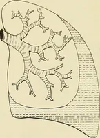 An illustration from The diseases of infancy and childhood : for the use of students and practitioners of medicine / by L. Emmett Holt and John Howland. (1911)