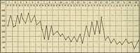 Picture 70 of 129 from The diseases of infancy and childhood : for the use of students and practitioners of medicine / by L. Emmett Holt and John Howland. (1911), leaf 606