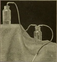 An illustration from The diseases of infancy and childhood : for the use of students and practitioners of medicine / by L. Emmett Holt and John Howland. (1911)