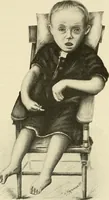 An illustration from The diseases of infancy and childhood : for the use of students and practitioners of medicine / by L. Emmett Holt and John Howland. (1911)