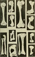 An illustration from The diseases of infancy and childhood : for the use of students and practitioners of medicine / by L. Emmett Holt and John Howland. (1911)