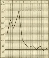 Picture 102 of 129 from The diseases of infancy and childhood : for the use of students and practitioners of medicine / by L. Emmett Holt and John Howland. (1911), leaf 951