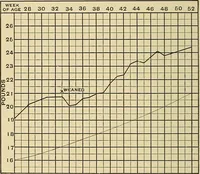 Picture 9 of 83 from The diseases of infancy and childhood : for the use of students and practitioners of medicine / by L. Emmett Holt with two hundred and forty-one illustrations, including eight coloured plates. (1908), leaf 206