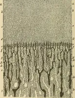 An illustration from The diseases of infancy and childhood : for the use of students and practitioners of medicine / by L. Emmett Holt with two hundred and forty-one illustrations, including eight coloured plates. (1908)