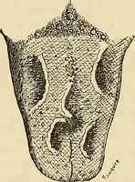 An illustration from The diseases of infancy and childhood : for the use of students and practitioners of medicine / by L. Emmett Holt with two hundred and forty-one illustrations, including eight coloured plates. (1908)