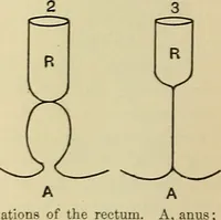 Picture 23 of 83 from The diseases of infancy and childhood : for the use of students and practitioners of medicine / by L. Emmett Holt with two hundred and forty-one illustrations, including eight coloured plates. (1908), leaf 384
