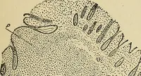 An illustration from The diseases of infancy and childhood : for the use of students and practitioners of medicine / by L. Emmett Holt with two hundred and forty-one illustrations, including eight coloured plates. (1908)
