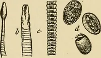 An illustration from The diseases of infancy and childhood : for the use of students and practitioners of medicine / by L. Emmett Holt with two hundred and forty-one illustrations, including eight coloured plates. (1908)
